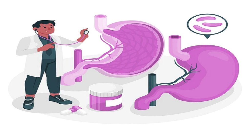 gastric bypass surgery in indore,gastric bypass surgery in indore, best gastric bypass surgery in indore,